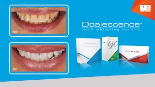 Professional Results with Opalescence™ teeth whitening [upl. by Aisak369]