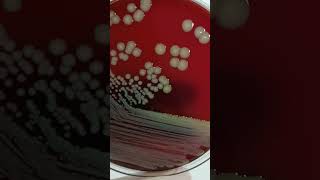 Conozcamos a Staphylococcus saprophyticus 🦠 [upl. by Cinemod954]