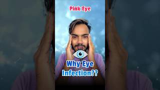 Eye Infection Conjunctivitis Pink Eye  Why is eye Infection Spreading in India fact short [upl. by Fiona]