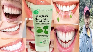 Perfora Classic Mint Toothpaste  Honest Review [upl. by Nakre]