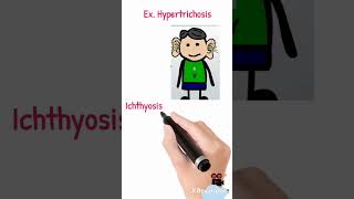 Holandric genes  Ylinked genes  Hypertrichosis  Ichthyosis [upl. by Notslah]