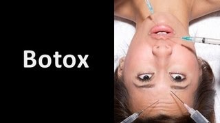 Botox Injections [upl. by Dawna]