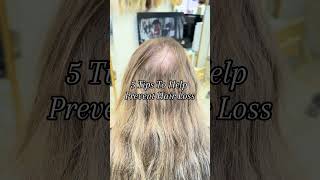 Stop Hair Loss NOW With These Simple Tips [upl. by Eniamurt]