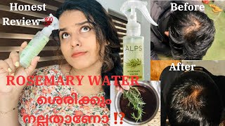 🥀💦 മുടി കൊഴിച്ചിൽ മാറും 🔥Result 💯‼️ Rosemary Water Alps GoodnessBEING US BY AJ [upl. by Cod]