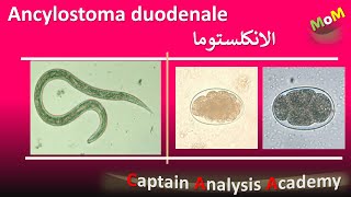 Ancylostoma duodenale  Hookworm الديدان الخطافية واذاى بتسبب انيميا نقص الحديد [upl. by Mersey]