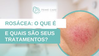 Vermelhidão no rosto Confira o que é Rosácea e como tratar com a dermatologista Dra Paula Ferreira [upl. by Anitnauq]