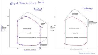 Altered pressure volume loops [upl. by Yecram]