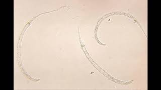 Dracunculus medinensis morphology life cycle pathogenesis diagnosis and treatment [upl. by Shalna]