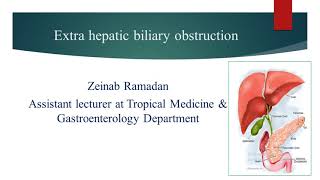 Extrahepatic biliary obstruction Algorithm  Dr Zeinab Ramadan [upl. by Marjorie689]