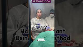 Hair Transplant By FUE Method  Renew  Skin Hair Laser  Dr Swati Dhyani  Delhi NCR  Indirapuram [upl. by Raphaela]