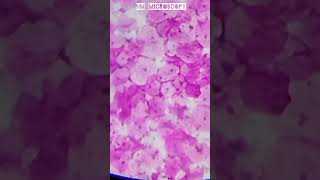 Squamous epithelial cells microscope slide🔬shortvideo youtube [upl. by Rector]