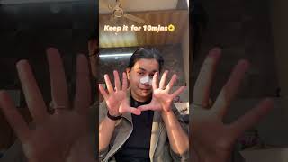 Nose Strips  Blackheads kaise hatae  Sanfe Nose Strip review 🤍 blackheads whiteheads [upl. by Obed]