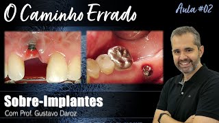 O Caminho ERRADO na Implantodontia  Curso SOBREIMPLANTES  Aula 02 [upl. by Ttoille]