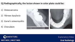 NEET MDS  INICET  Oral Radiology  Explanatory Video  MERITERS [upl. by Lleder]