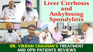 Liver Cirrhosis and Ankylosing Spondylitis  Dr Vikram Chauhans Treatment and OPD Patients Reviews [upl. by Dianne401]