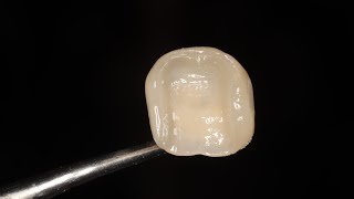 Emax cementation full protocol [upl. by Eveivaneg]