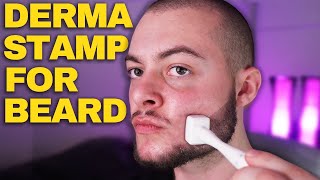 How To Derma Stamp Beard Properly Derma Stamp Tutorial Minoxidil amp Derma Stamp [upl. by Schlesinger]