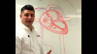 Neonatal Circulation Part 13 Preductal Sp02 [upl. by Eerahs536]