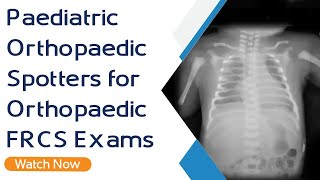 Paediatric Orthopaedic Spotters for Orthopaedic FRCS Exams  Orthopaedic Academy [upl. by Dimitry167]