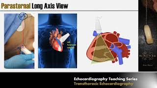 Lecture 2  Transthoracic Echocardiography Part 1 [upl. by Mccandless]