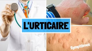 URITCAIRE  CAUSES  SYMPTOMES  COMPLICATIONS  TRAITEMENT [upl. by Mandych211]