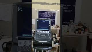 Thoracentesis in Labrador retriever 🐶 labradorretriever dog animals veterinary viralvideo [upl. by Dotti905]