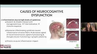 Dinner with the Doctor  Neurological Effects of Celiac Disease [upl. by Ojillib560]