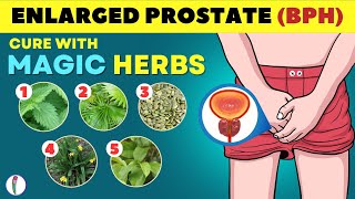 🔥 Magic Herbs to Cure Enlarged Prostate  Prostate enlargement Treatment  BPH Treatment [upl. by Sauncho]