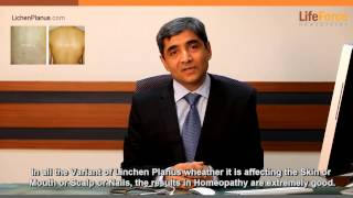 Lichen Planus and its homeopathic treatment explained by Dr Rajesh Shah MD [upl. by Vieva]