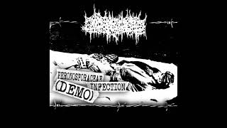 Septic Gangrenous Osteolysis  Peronosporaceae Infection Gorenoise [upl. by Eiramait]