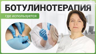 Ботулинотерапия что это за процедура и как она проходит [upl. by Corneille706]