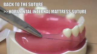 Back to the suture   3 Horizontal internal mattress suture [upl. by Yalc]