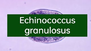 Echinococcus granulosus II Life cycle of Echinococcus granulosus II Morpof Echinococcus granulosus [upl. by Nessim]