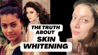 Bollywood Actress Skin Whitening Treatment I Whitening Injection I Whitening Treatment for Skin [upl. by Aelrac]