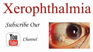 Xerophthalmia Introduction and Causes of Vitamin A Deficiency [upl. by Leonie]