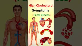 STOP Ignoring These Warning Signs of High Cholesterol [upl. by Letnuahs]