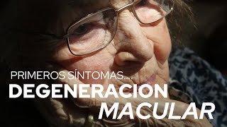 ¿Que es la MACULOPATIA o DEGENERACIÓN MACULAR¿Cuáles son los sintomas Dr Alejandro Lavaque [upl. by Ful]