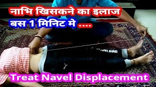 NAVEL DISPLACEMENT PERMANENT CURE IN 1 MINUTEनाभि खिसकना धरन पड़ना इलाज बस १ मिनिटमे [upl. by Kahlil689]