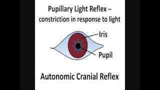 Pupillary Light Reflex  Cranial Nerves II amp III [upl. by Ahsena296]