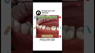 Caries removing process3D animation surgeon surgeryrecovery [upl. by Atiuqin379]