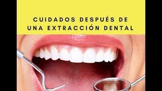 Cuidados después de una extracción dental [upl. by Shulem859]