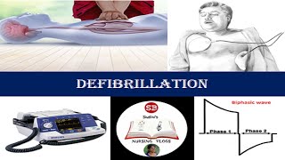 DEFIBRILLATION  INDICATIONS TYPES WAVEFORMS PRE CHECKS STEPS AND POST CARE [upl. by Sitto]