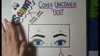 Types of squint and Cover uncover test [upl. by Neill260]