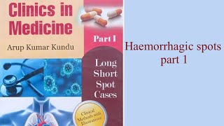 Haemorrhagic Spots part 1 [upl. by Groome]