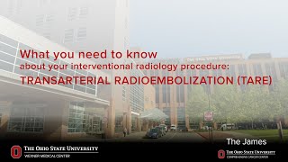 TARE transarterial radioembolization  Ohio State Medical Center [upl. by Fuller114]