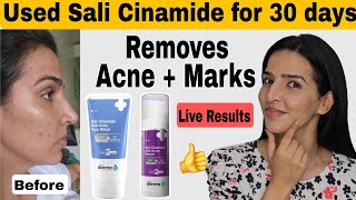 I tried Derma co Sali cinamide serum  Removes pimples and acne marks acne [upl. by Ailsa]