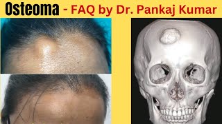 Osteoma  Common Questions and answers Scarless Osteoma Removal surgery How to remove osteoma [upl. by Blunk]