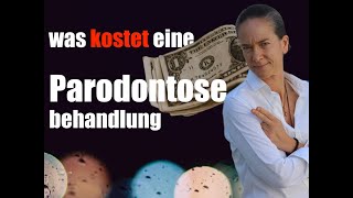 ParodontitisBehandlung was KOSTET das [upl. by Wie866]