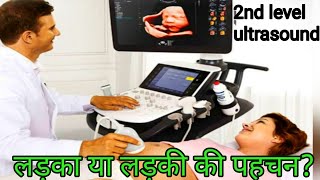 🤱🥰Ultrasound se Jane ladka ya ladkiSonography se kaise Jane ladka hai ya ladki2nd level ultrasound [upl. by Greenwell]