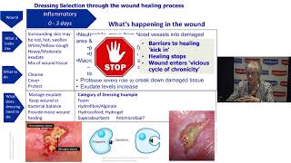 Understanding Wound Dressings Categories and Indications [upl. by Carrol]